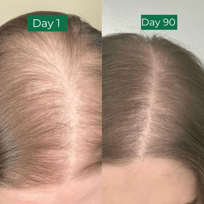 SimplyWellness™ Hair & Skin Glow Bundle